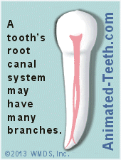 Animation showing a branched root canal system.